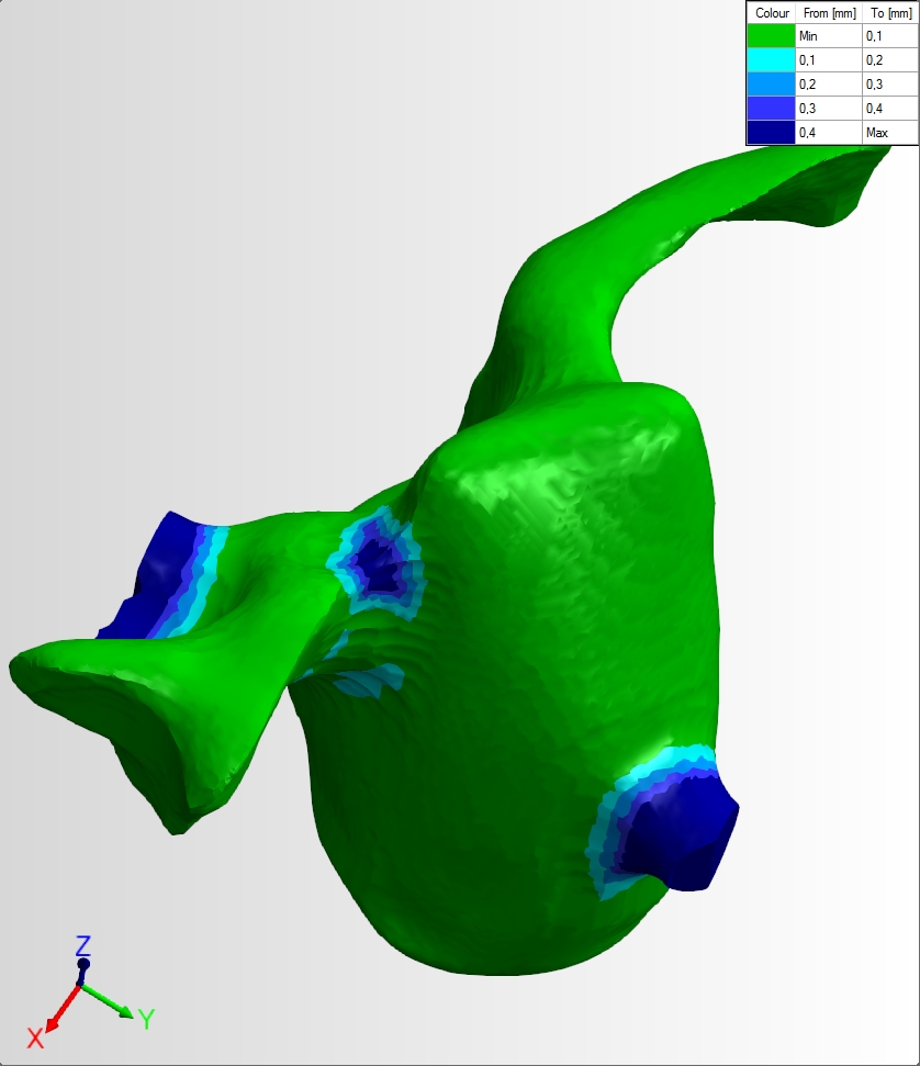 DentalCAM – List of calulcated objects/residual material display